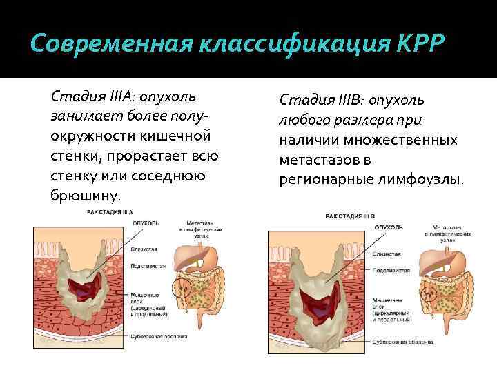 Колоректальный анализ