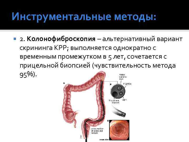 Инструментальные методы: 2. Колонофиброскопия – альтернативный вариант скрининга КРР; выполняется однократно с временным промежутком