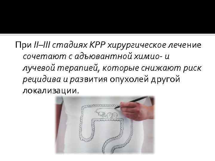 При II–III стадиях КРР хирургическое лечение сочетают с адъювантной химио- и лучевой терапией, которые