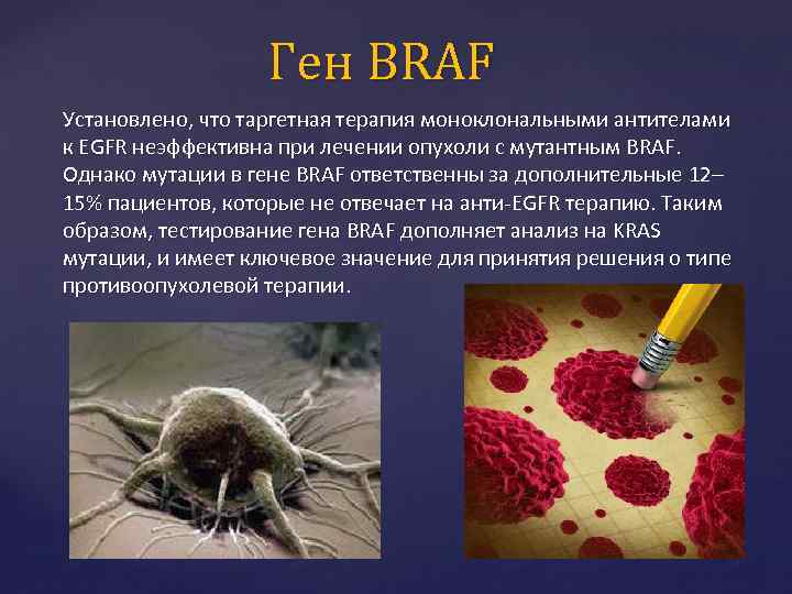 Ген BRAF Установлено, что таргетная терапия моноклональными антителами к EGFR неэффективна при лечении опухоли