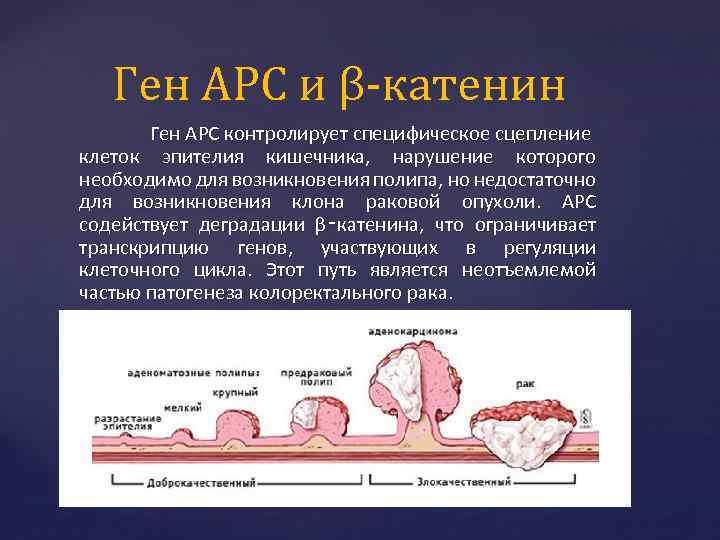 Ген APC и β‑катенин Ген APC контролирует специфическое сцепление клеток эпителия кишечника, нарушение которого