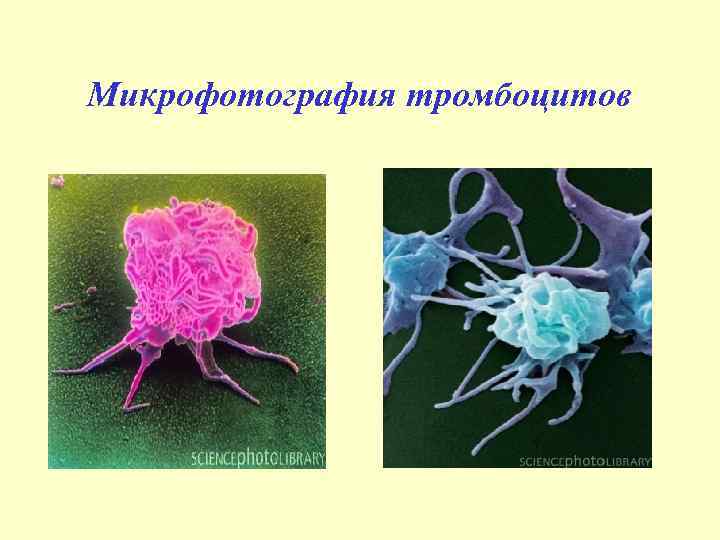 Микрофотография тромбоцитов 