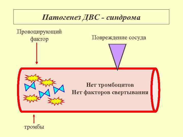 Патогенез ДВС - синдрома Провоцирующий фактор Повреждение сосуда Нет тромбоцитов Нет факторов свертывания тромбы