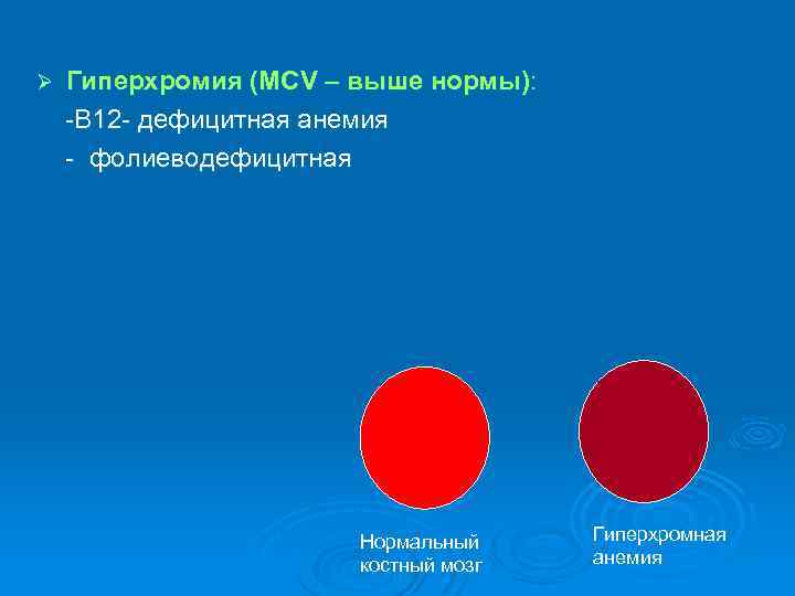 Гиперхромия (MCV – выше нормы): В 12 дефицитная анемия фолиеводефицитная Ø Нормальный костный мозг