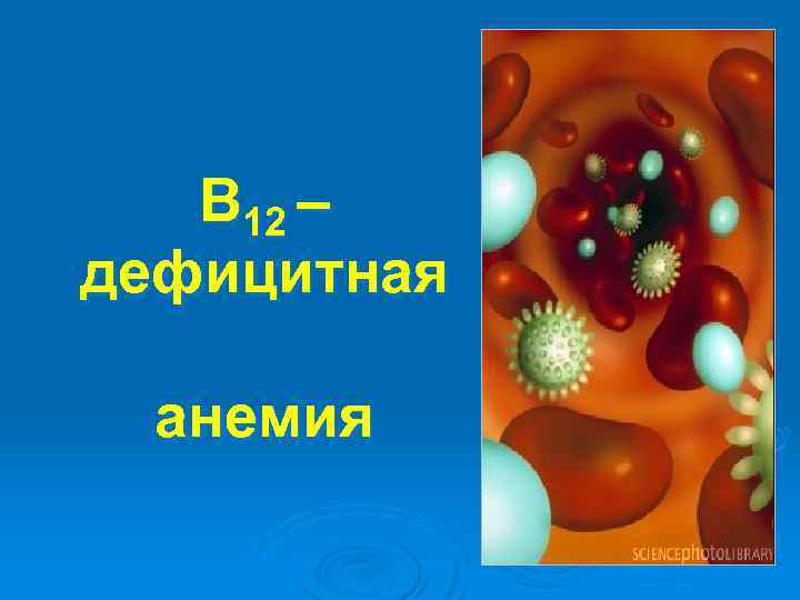 В 12 – дефицитная анемия 
