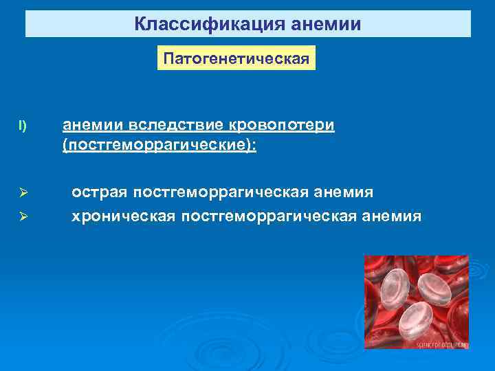 Классификация анемии Патогенетическая I) анемии вследствие кровопотери (постгеморрагические): Ø острая постгеморрагическая анемия хроническая постгеморрагическая