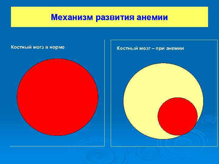 Механизм развития анемии Костный мозг – при анемии 