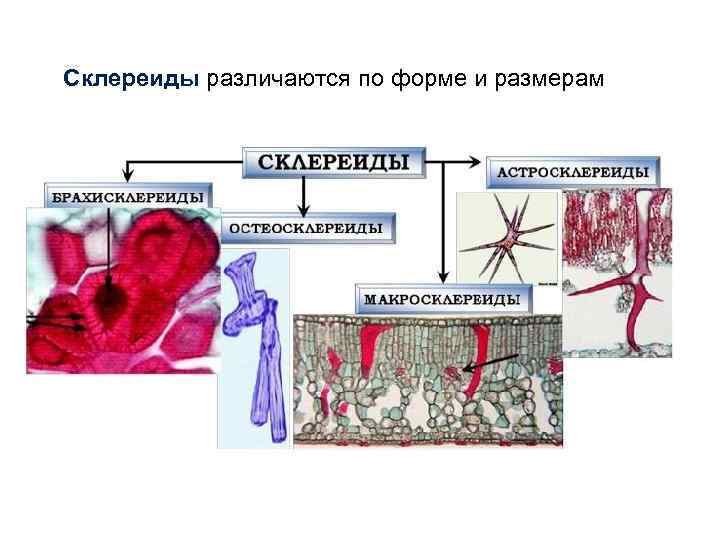 Склереиды различаются по форме и размерам 