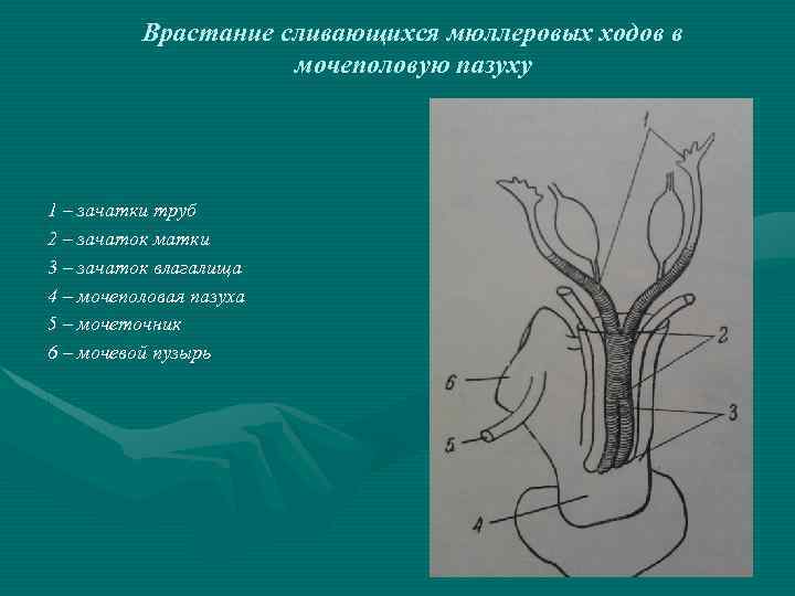 Врастание сливающихся мюллеровых ходов в мочеполовую пазуху 1 – зачатки труб 2 – зачаток