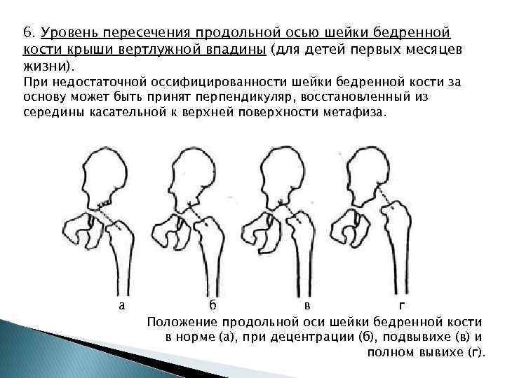 Шейка бедра карта вызова