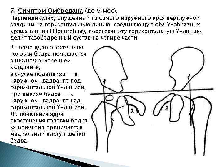 Схема хильгенрейнера тазобедренных суставов у детей