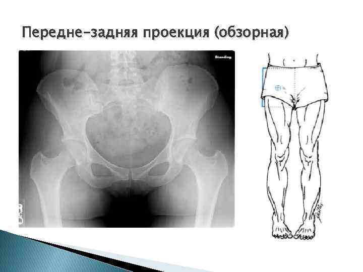 Передне-задняя проекция (обзорная) 