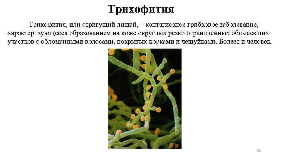 Трихофития, или стригущий лишай, – контагиозное грибковое заболевание, характеризующееся образованием на коже округлых резко