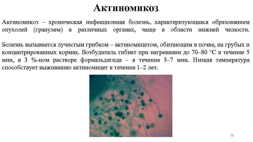 Актиномикоз – хроническая инфекционная болезнь, характеризующаяся образованием опухолей (гранулем) в различных органах, чаще в