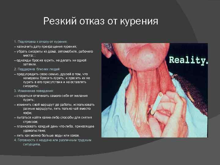 Резкий отказ от курения 1. Подготовка к отказу от курения: – назначить дату прекращения