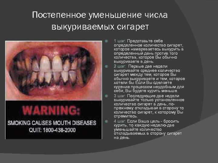 Постепенное уменьшение числа выкуриваемых сигарет 1 шаг: Представьте себе определенное количество сигарет, которое намереваетесь