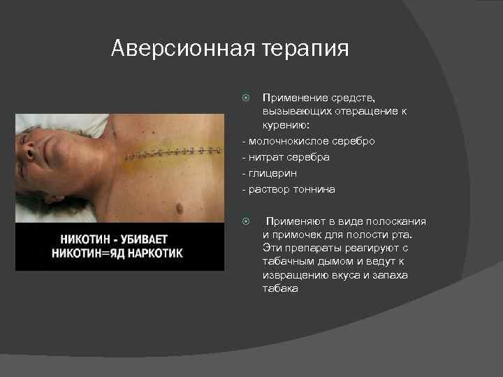 Аверсионная терапия Применение средств, вызывающих отвращение к курению: - молочнокислое серебро - нитрат серебра