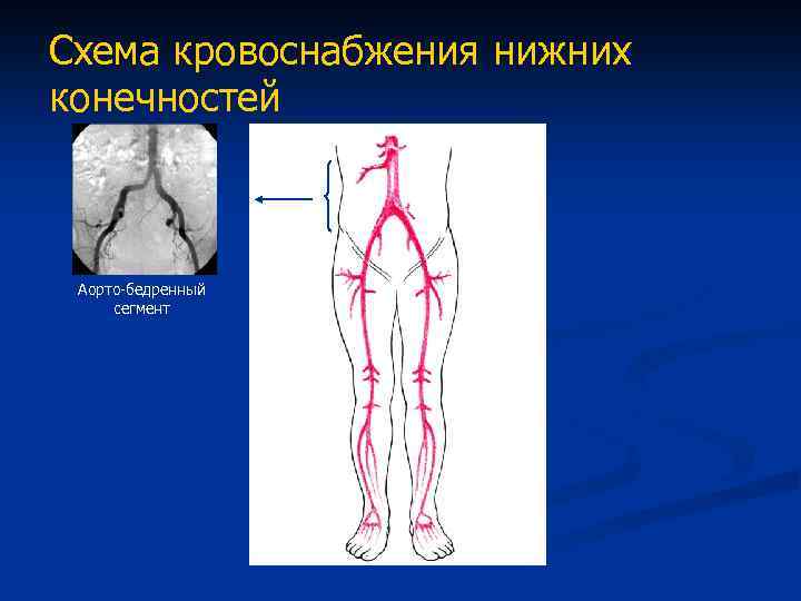 Вены нижних конечностей мкб