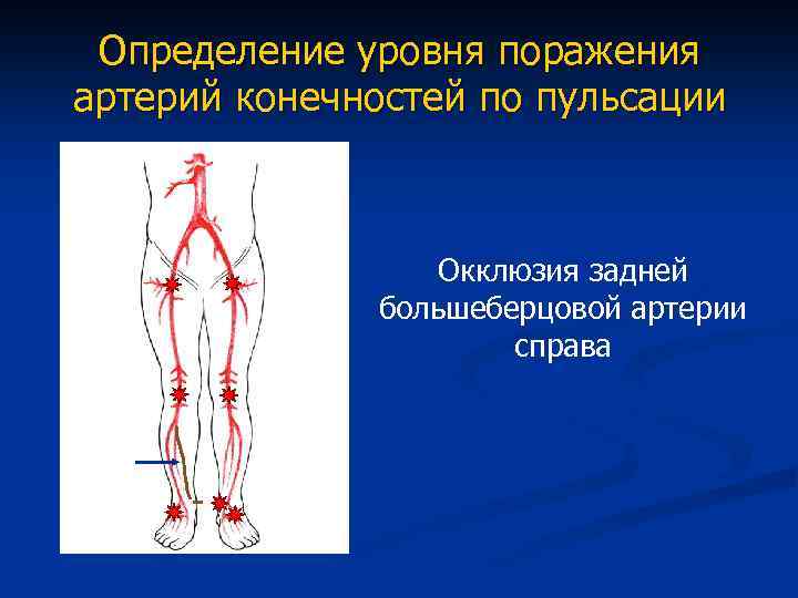 Атеросклероз нижних конечностей карта вызова скорой помощи