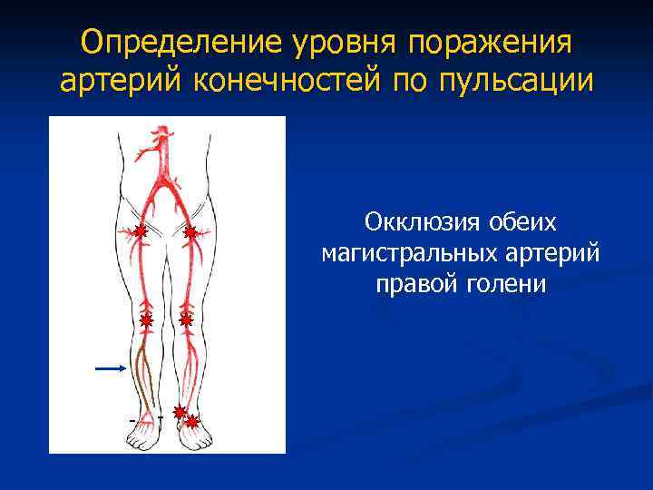 Атеросклероз нижних конечностей карта вызова скорой помощи