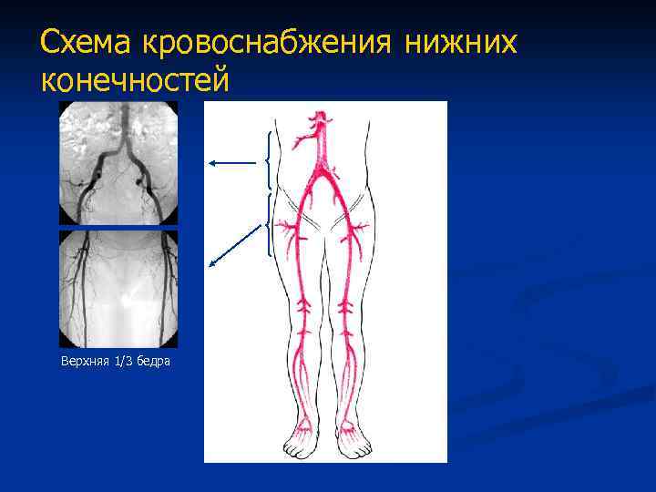 Кровообращение нижних конечностей