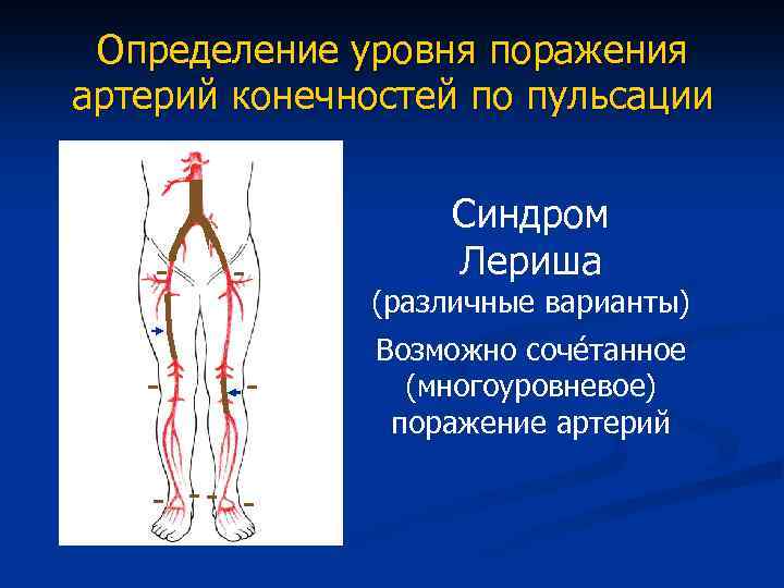 Атеросклероз нижних конечностей карта вызова скорой помощи