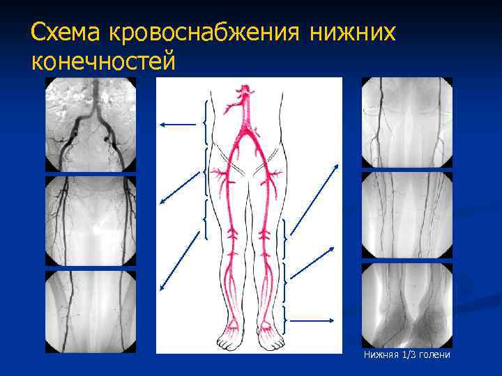 Уколы для кровообращения нижних конечностей