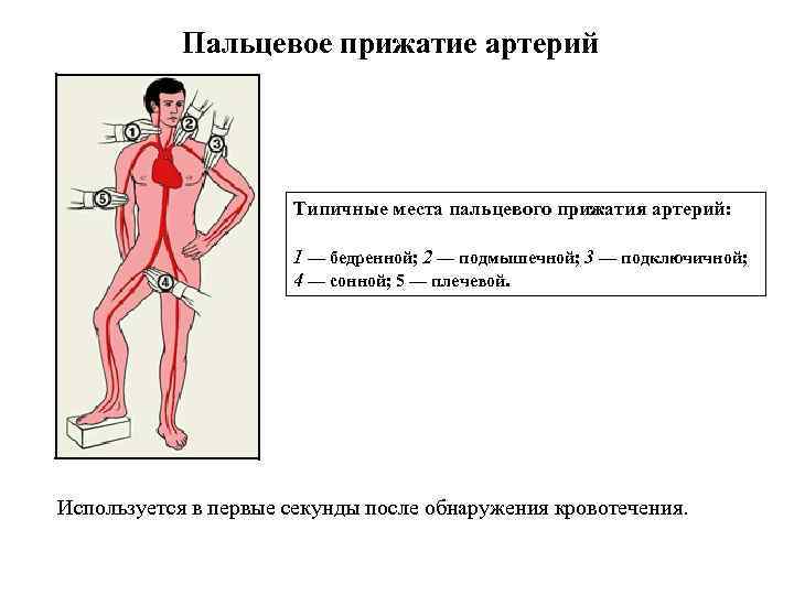 Фото пальцевое прижатие артерии