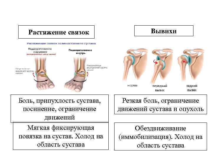 Как отличить болит. Растяжения, повреждения связок.. Вывих, подвывих, растяжение связок. Стадии вывихи голеностопного сустава. Признаки повреждений растяжение связок.