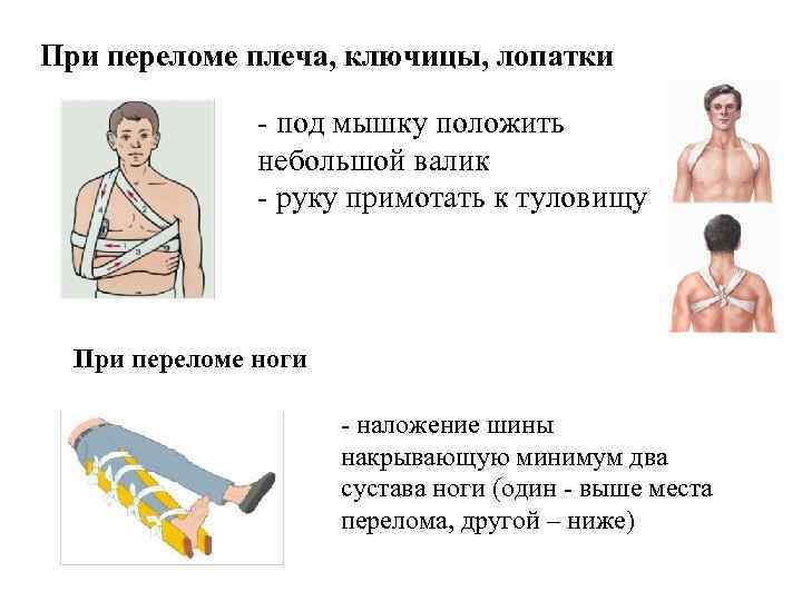 Перелом ключицы первая помощь. Оказание помощи пострадавшему при переломе ключицы. Оказание ПМП при переломе ключицы. Транспортировкапри переломе клюяицы. Транспортировка при переломе ключицы.