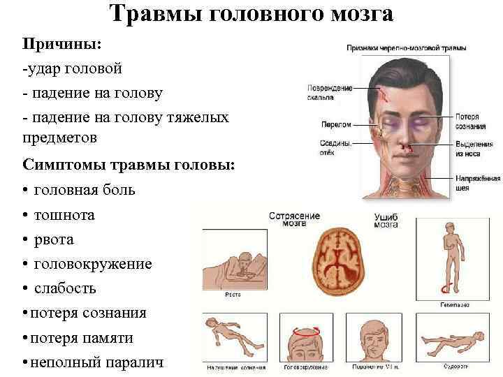 Травмы головного мозга Причины: -удар головой - падение на голову тяжелых предметов Симптомы травмы
