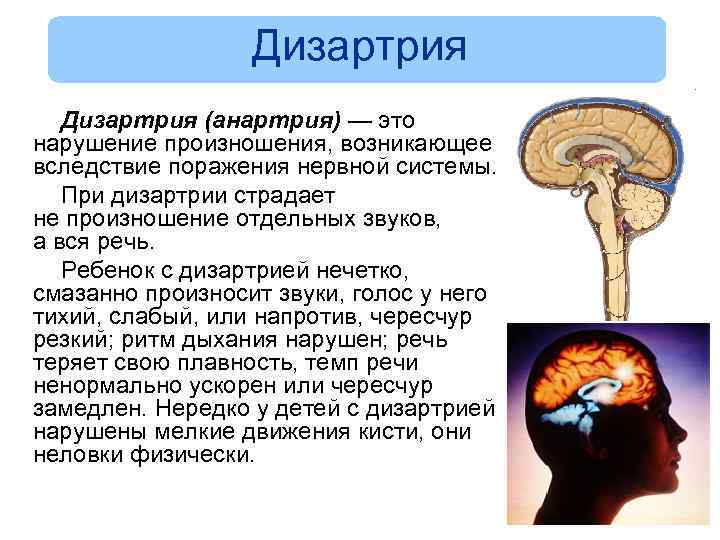 Дизартрия (анартрия) — это нарушение произношения, возникающее вследствие поражения нервной системы. При дизартрии страдает