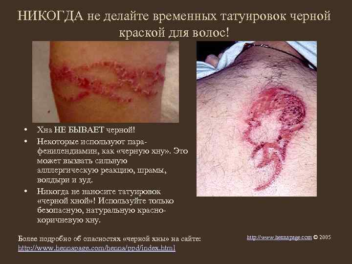 НИКОГДА не делайте временных татуировок черной краской для волос! • • • Хна НЕ