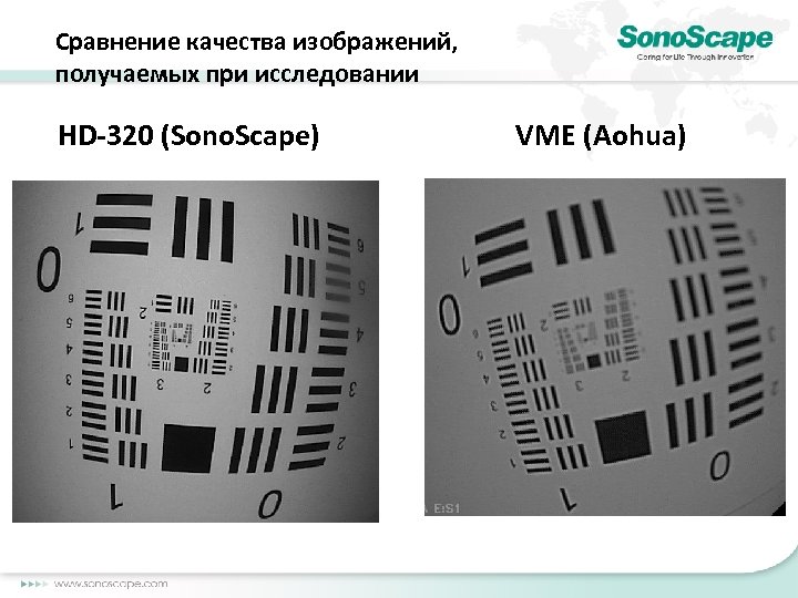 Сравнение качества изображений, получаемых при исследовании HD-320 (Sono. Scape) VME (Aohua) 