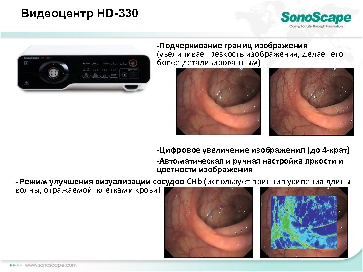 Видеоцентр HD-330 -Подчеркивание границ изображения (увеличивает резкость изображения, делает его более детализированным) -Цифровое увеличение