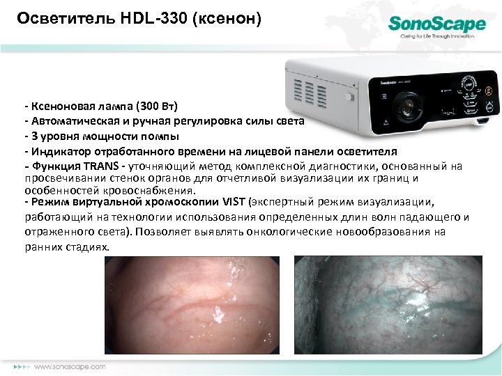 Осветитель HDL-330 (ксенон) - Ксеноновая лампа (300 Вт) - Автоматическая и ручная регулировка силы