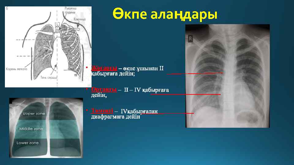 Өкпе алаңдары • Жоғарғы • Ортаңғы • Төмеңгі 