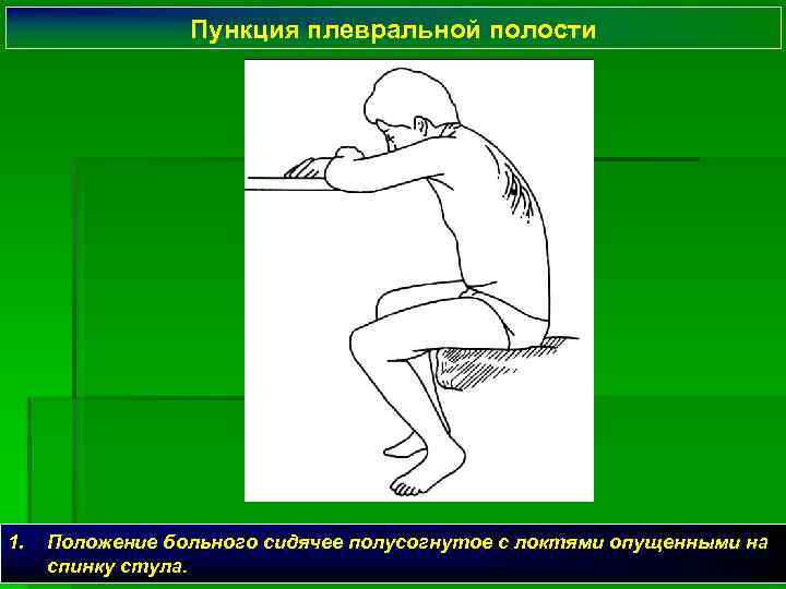 Пункция плевральной полости 1. Положение больного сидячее полусогнутое с локтями опущенными на спинку стула.