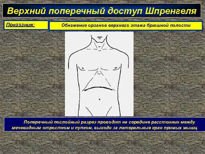 Верхний поперечный доступ Шпренгеля Показания: Обнажение органов верхнего этажа брюшной полости Поперечный послойный разрез