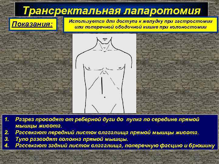 Трансректальная лапаротомия Показания: 1. 2. 3. 4. Используется для доступа к желудку при гастростомии