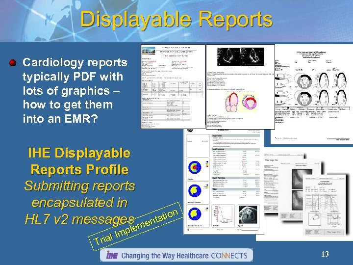 Displayable Reports Cardiology reports typically PDF with lots of graphics – how to get
