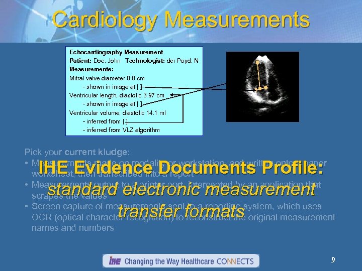 Cardiology Measurements Echocardiography Measurement Patient: Doe, John Technologist: der Payd, N Measurements: Mitral valve