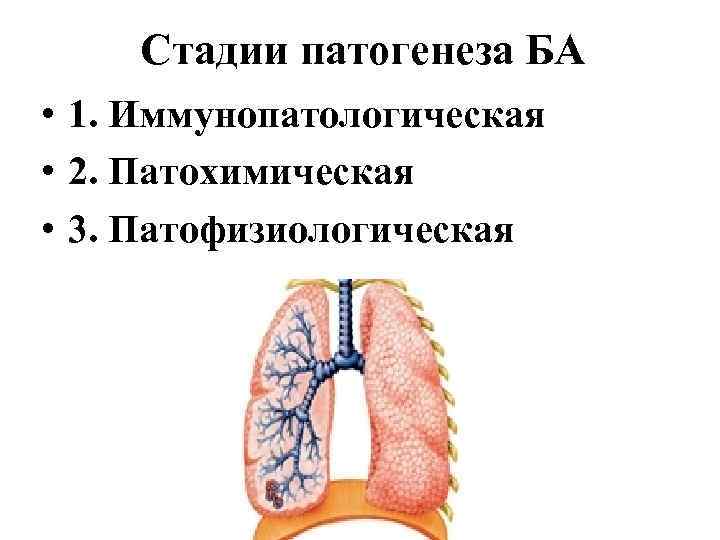 Стадии патогенеза БА • 1. Иммунопатологическая • 2. Патохимическая • 3. Патофизиологическая 