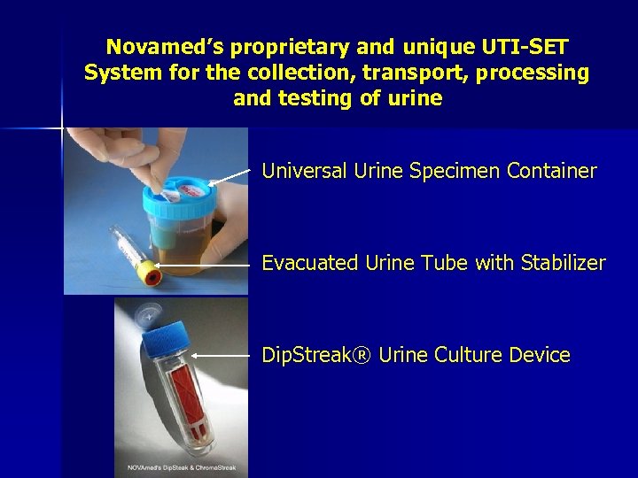 Novamed’s proprietary and unique UTI-SET System for the collection, transport, processing and testing of