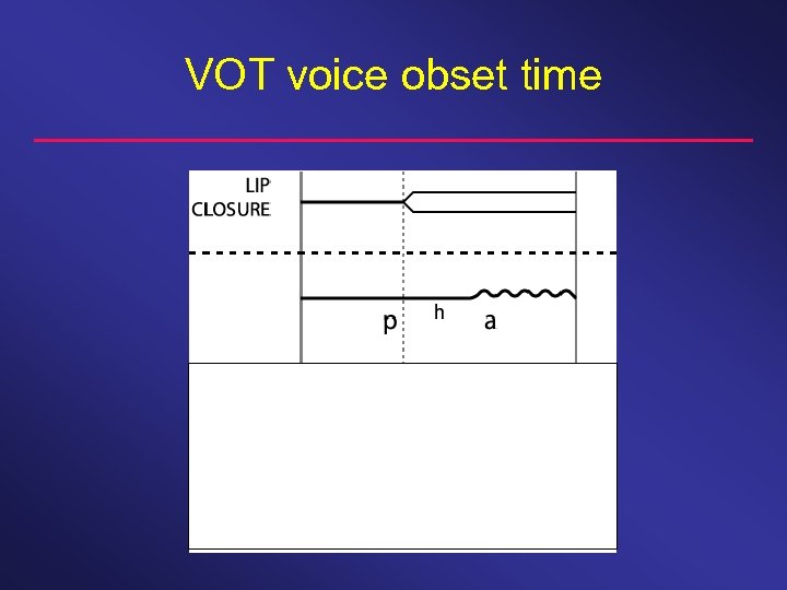 VOT voice obset time 
