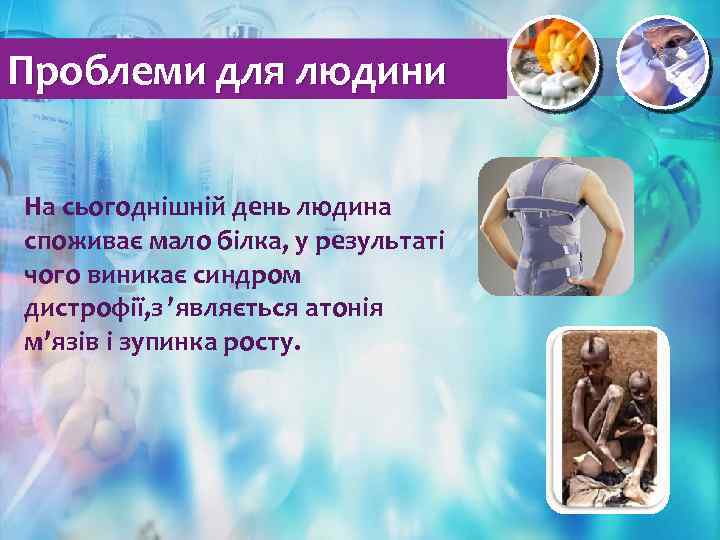 Проблеми для людини На сьогоднішній день людина споживає мало білка, у результаті чого виникає