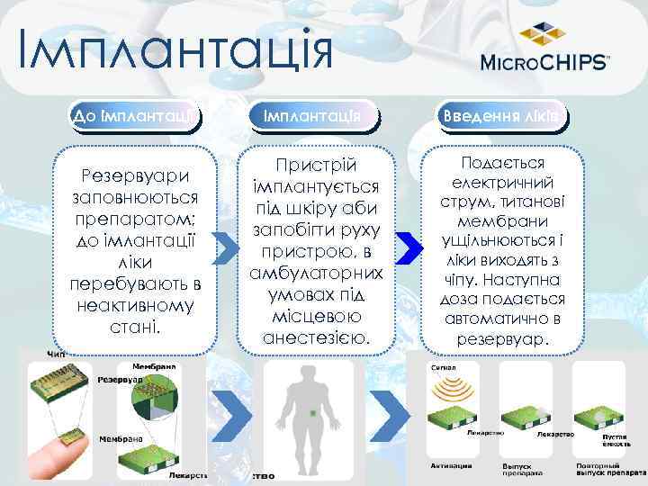 Імплантація До імплантації Імплантація Введення ліків Резервуари заповнюються препаратом; до імлантації ліки перебувають в