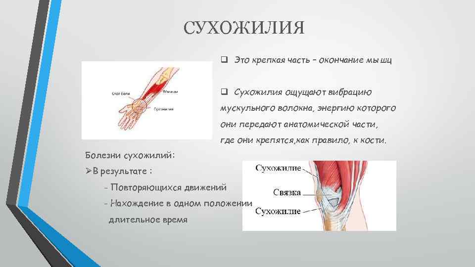 Карта сухожилий человека