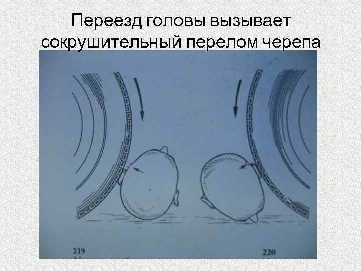 Переезд головы вызывает сокрушительный перелом черепа 
