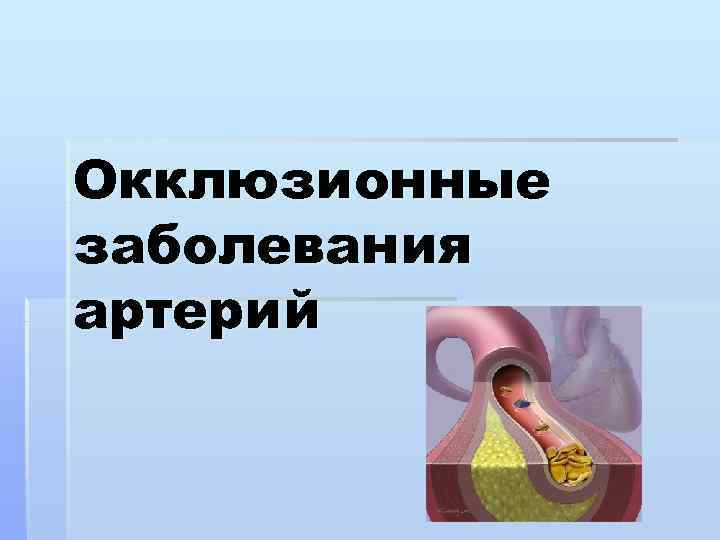 Окклюзионные заболевания артерий 